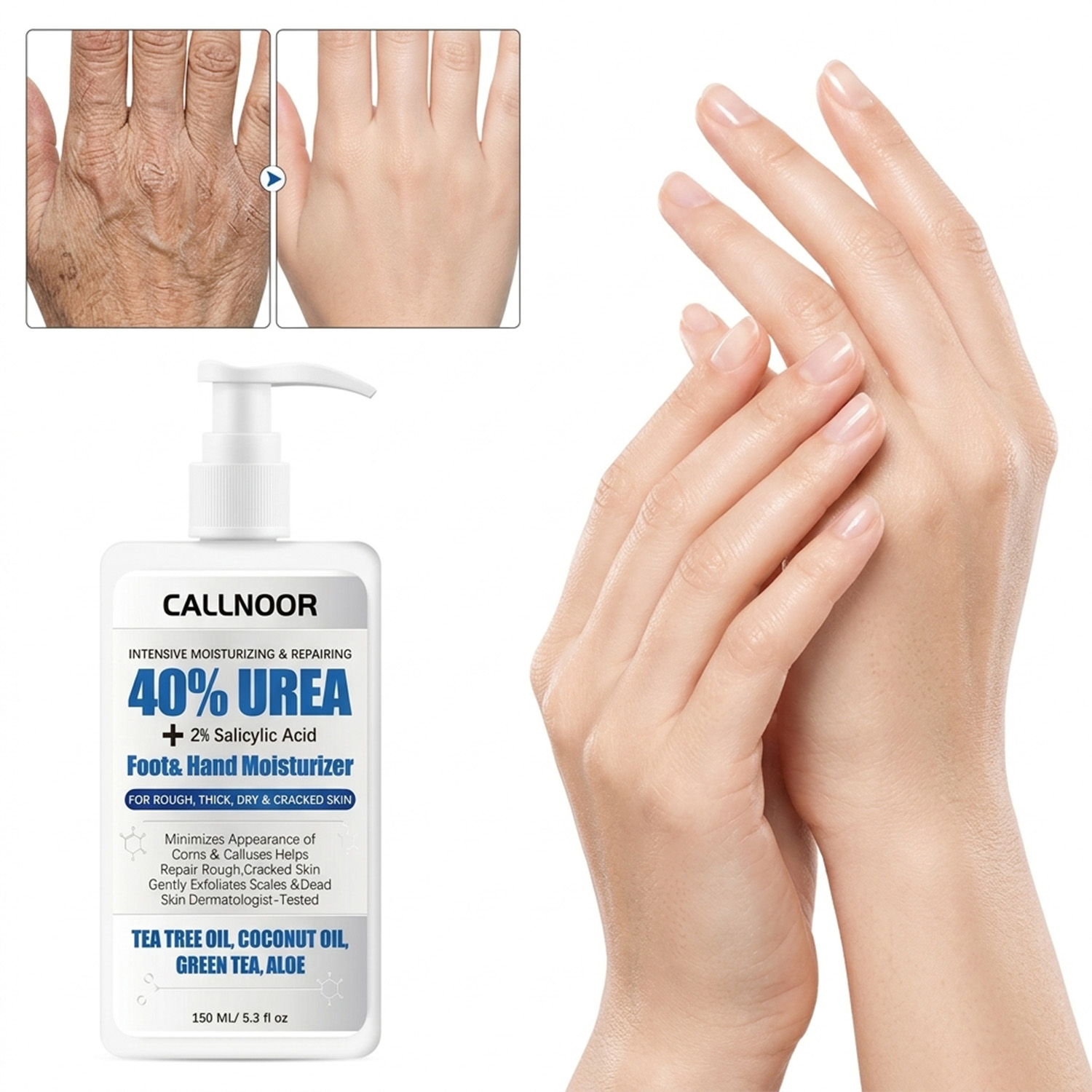 Urea Foot Cream - 0% Urea Hand- und Fußcreme 2%