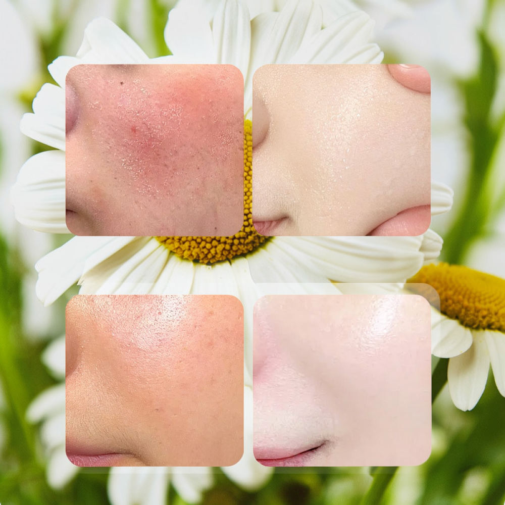Face Mask Skincare - Für Fykly Rose VC Kamille B5