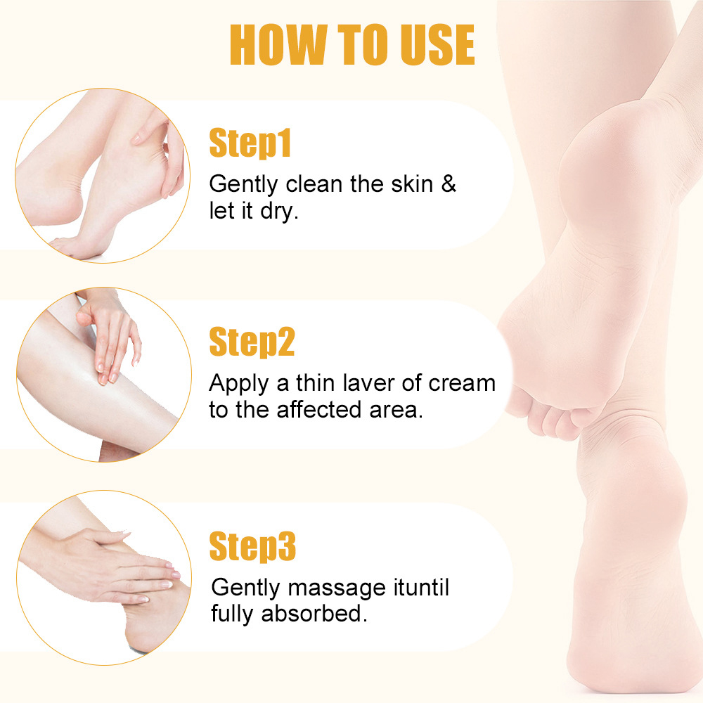 Harnstoffcreme, 60 % Salicylsä – Urea Foot Cream Bewertung und Preis