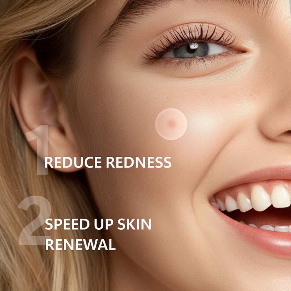 Unsichtbare Mikro-Nadel-Akne-P – Face Oil Bewertung und Preis