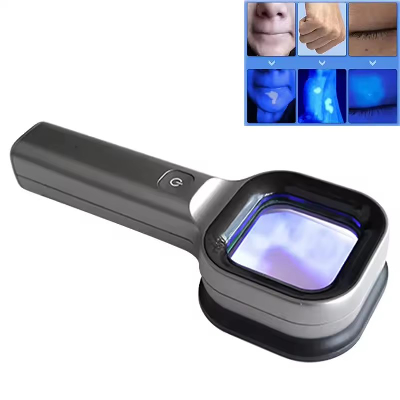Woods Lamp Hautanalysator Haut – Skincare Glowing Bewertung und Preis