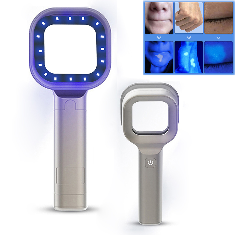 Woods Lamp Hautanalysator Haut – Skincare Glowing Bewertung und Preis