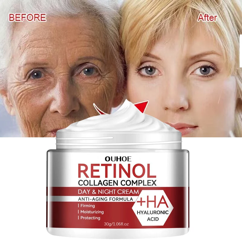 Retinol-Creme, feuchtigkeitssp – Retinol Cream Bewertung und Preis
