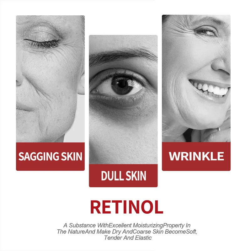 Retinol-Creme, feuchtigkeitssp – Retinol Cream Bewertung und Preis