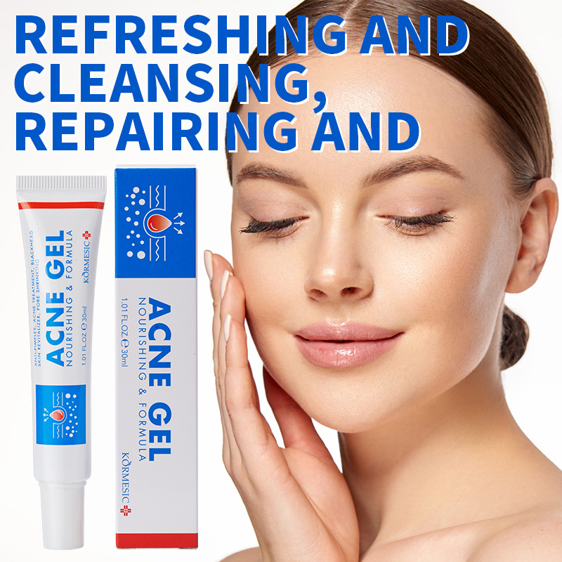 30g Akne-Entfernungs-Gel Tiefe – Face Moisturizer Bewertung und Preis